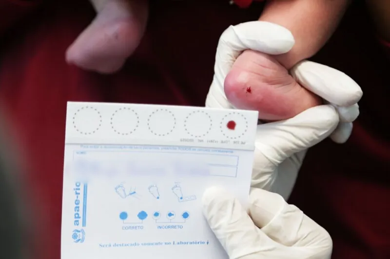 O município realiza uma média de 630 exames deste tipo por mês