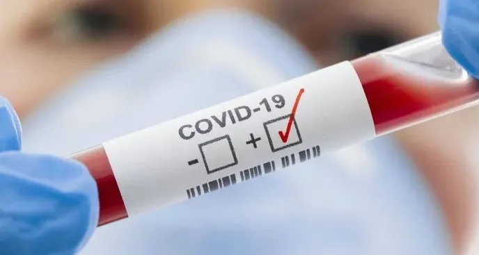 Taxa de mortalidade por Covid-19 no estado do Rio é de 5,83%
