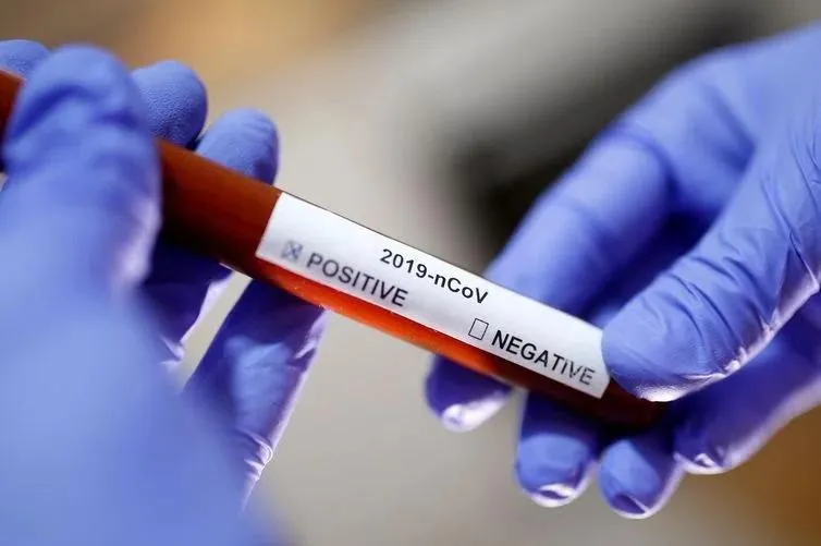 Imagem ilustrativa da imagem Fiocruz aponta que pacientes que tiveram casos leves da Covid-19 podem ter infecções severas