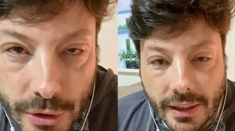 Danilo Gentilli assustou os fãs ao aparecer na web com o rosto deformado