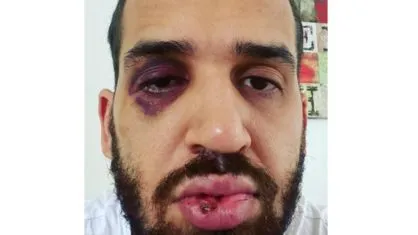 O médico compartilhou uma foto de seu rosto após as agressões nas redes sociais