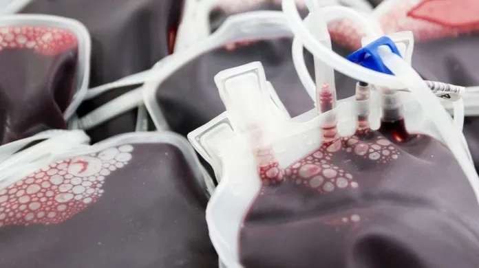 Imagem ilustrativa da imagem Clínica de Hemoterapia em Niterói estuda as propriedades do plasma contra Covid-19