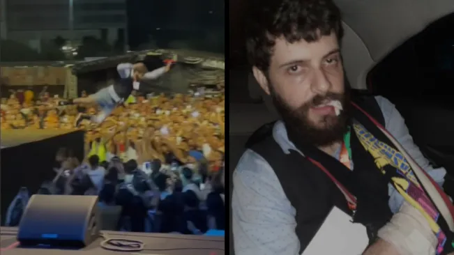 Artista teve um dente e um braço quebrado