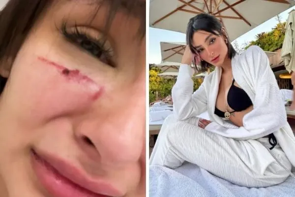 Imagens divulgadas nas redes sociais mostram sinais da agressão
