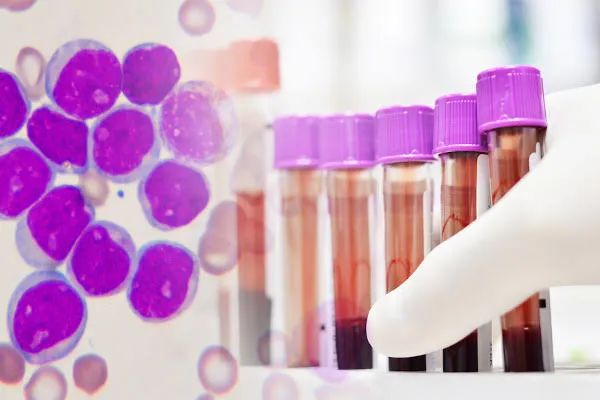 Prevenção à leucemia