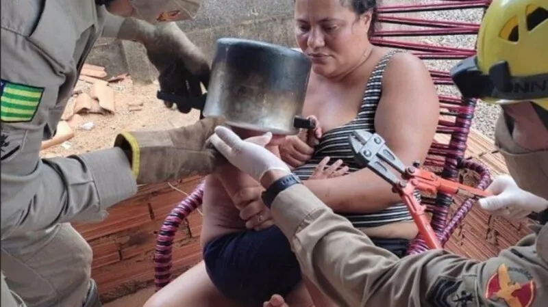Acidente aconteceu quando a criança brincava com a panela