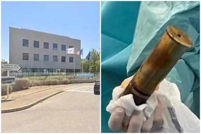 Paciente afirmou ter inserido artefato no ânus para prazer sexual