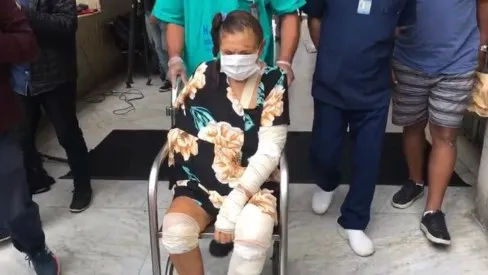 Idosa recebeu alta após passar por cirurgias