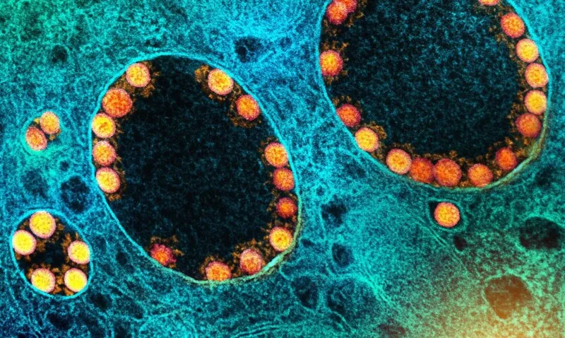 Desde o início da pandemia, o país acumula 33,3 milhões de casos confirmados da doença e 675,8 mil mortes registradas