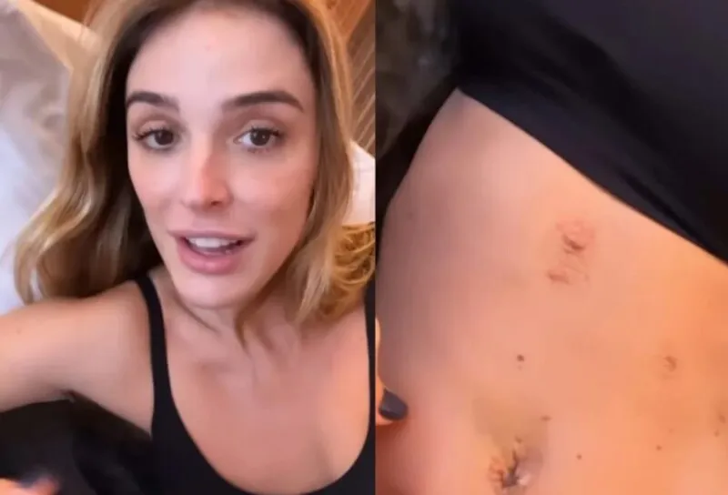 A apresentadora revelou que apesar de pensar na estética, seu foco era acabar com as dores que sentia