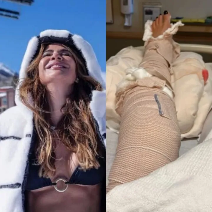 Luciana Gimenez sofreu acidente na neve