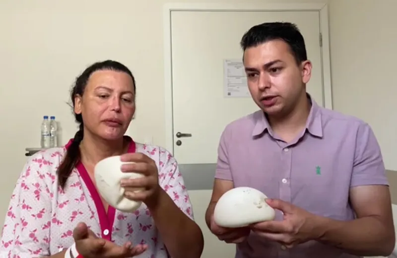 Luísa Marilac segue em recuperação após retirar a prótese mamária