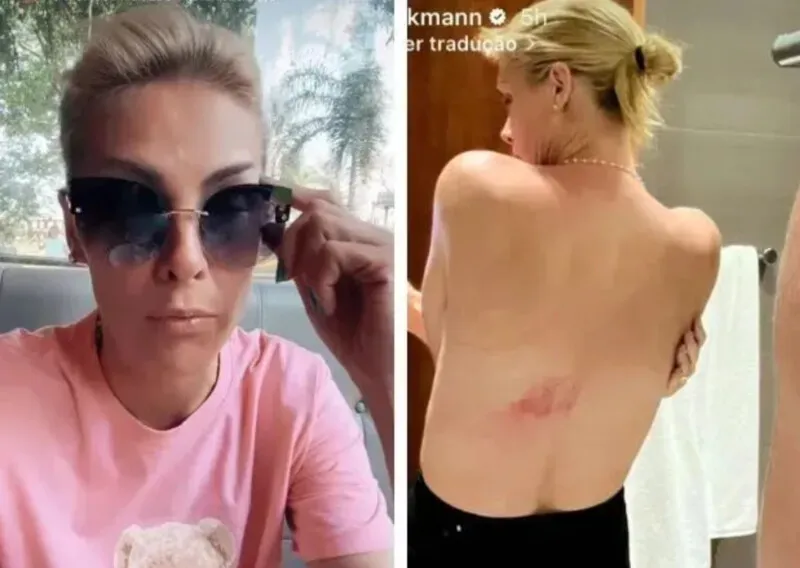 A apresentadora Ana Hickmann sofreu uma queda de cavalo em um sítio de São Paulo