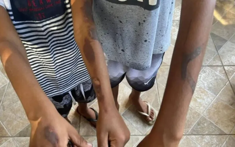 No local, os policiais constataram os ferimentos