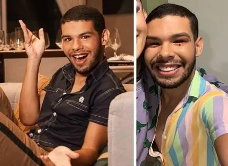 Viny antes e depois da prótese