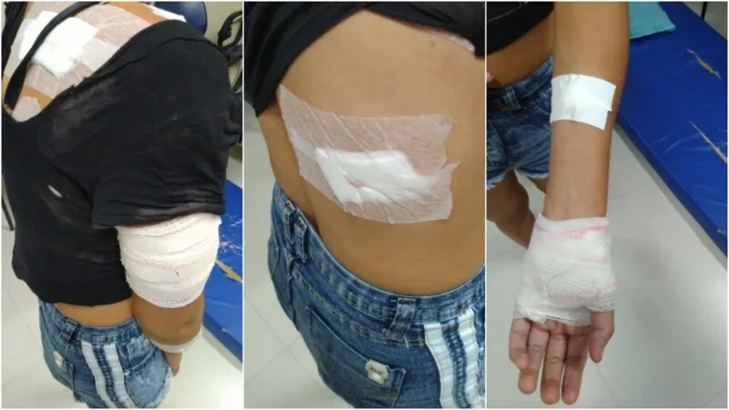 A mulher conseguiu sobreviver porque nenhum ponto vital foi atingido pelas facadas