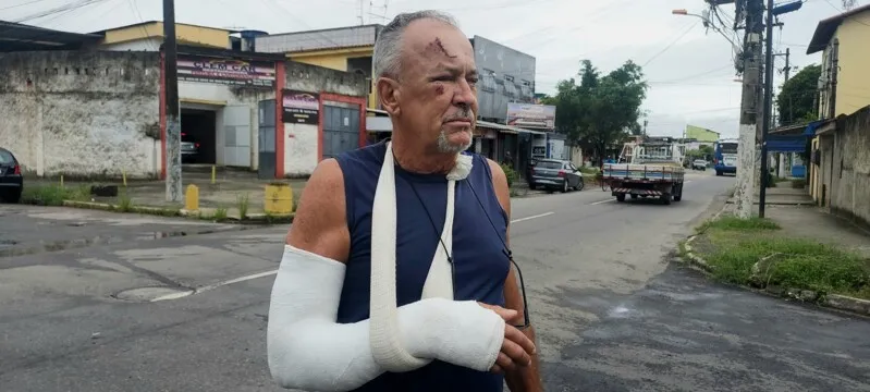 José foi atropelado no seu horário de almoço no Porto da Pedra