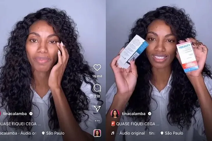 Tina Calambra revela quase ter perdido sua visão após fazer o uso de uma pomada modeladora para cabelos