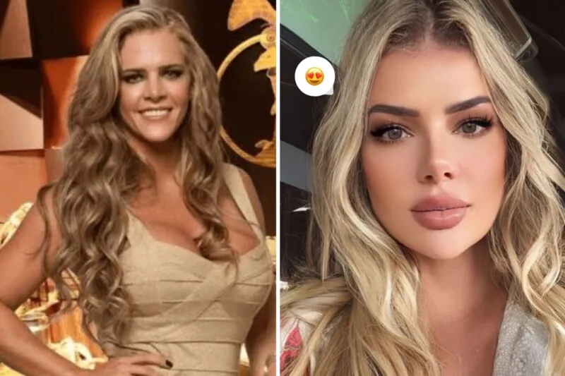 Além das mudanças faciais, os internautas apontaram mudanças no corpo