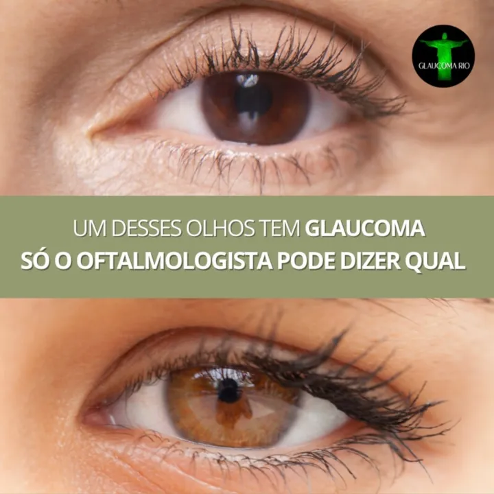 O glaucoma é a segunda causa de cegueira no Brasil