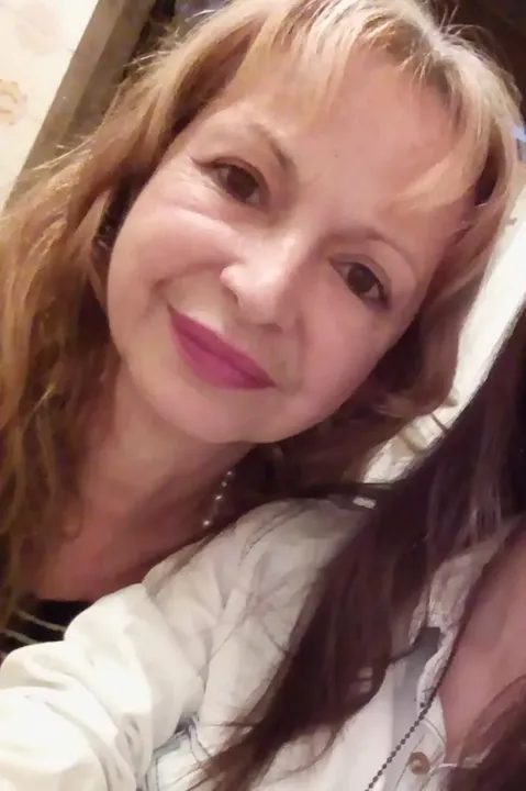 Vera Lúcia teria sofrido um hematoma facial após cirurgia plástica