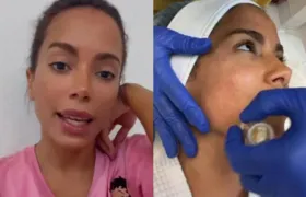 Anitta faz tratamento estético com o próprio sangue