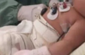 Enfermeira acusada por bebê queimada em Niterói será julgada na próxima semana