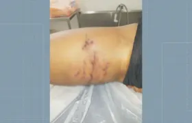 Mulher é atacada por pitbull em parque na Zona Sul do Rio