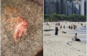 Trabalhador é ferido em assalto a quiosque na Praia de Icaraí
