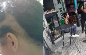 Garçonete grávida sofre ataque racista em bar no Flamengo, no Rio