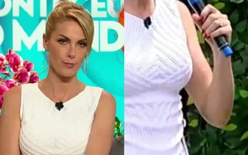 A apresentadora Ana Hickmann apareceu na TV com um hematoma no seu braço esquerdo
