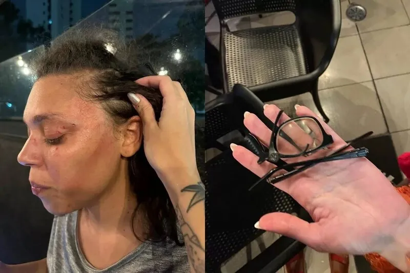 Óculos da vítima foram quebrados com a agressão