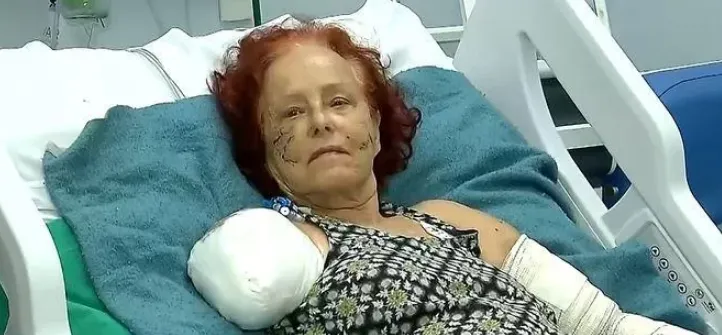 Roseana foi atacada por pibulls na rua de sua casa, em Saquarema