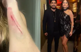 Campeã do BBB denuncia comediante por agressão