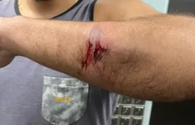 Engenheiro é agredido por homem com pedaço de pau em Icaraí, Niterói