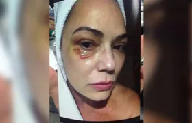 Luiza Brunet pede indenização milionária ao ex-marido por dano moral e patrimonial