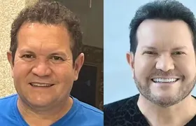 Ximbinha faz nova harmonização facial e exibe o resultado nas redes sociais