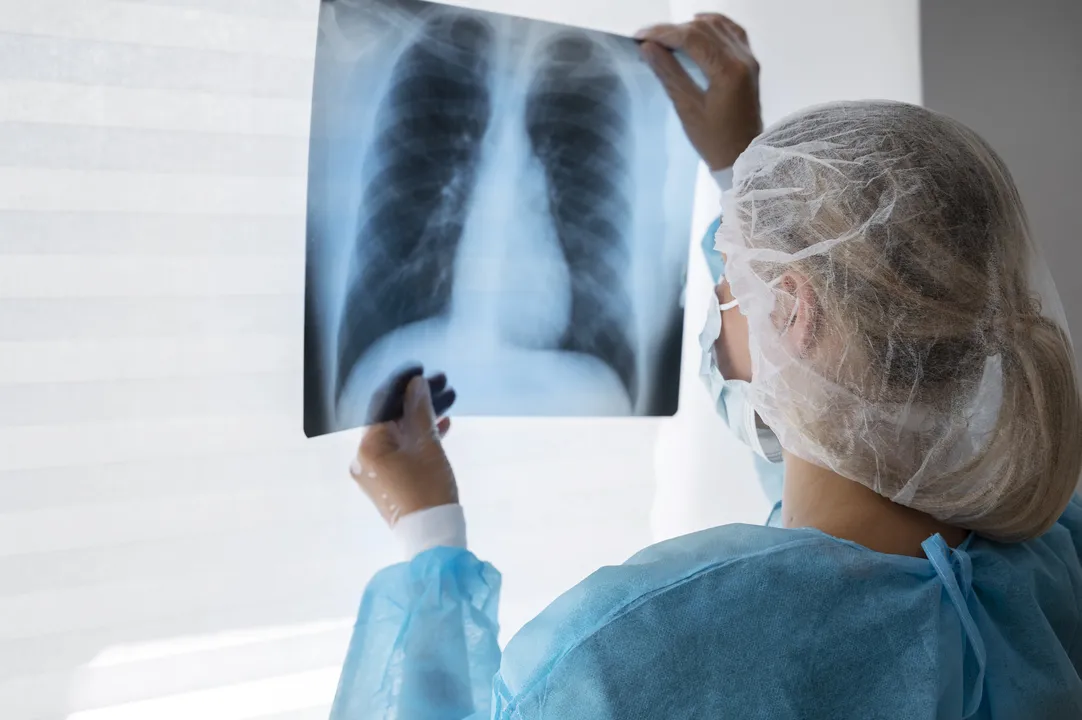 O Conselho de Radiologia vem registrando um aumento de denúncias