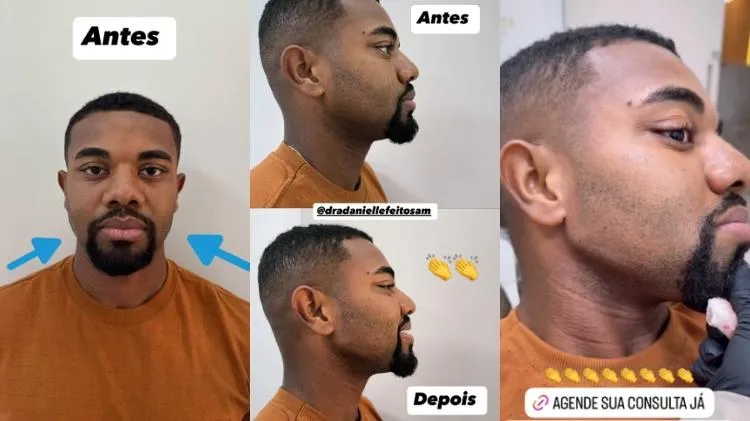 Não dói nada”, relatou o baiano