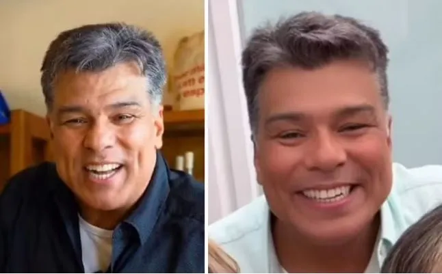 Mauricio Mattar, antes e depois da harmonização facial