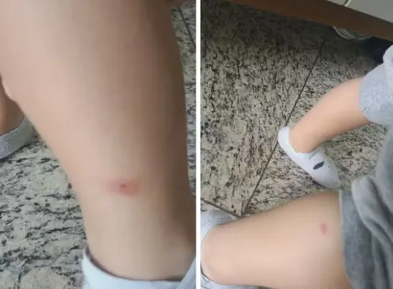 Pais denunciam infestação de pulgas e carrapatos em creche de Botafogo