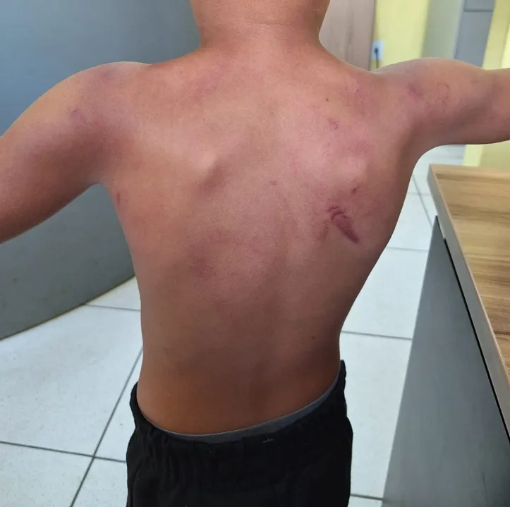 Diante das evidências, a autora foi autuada por maus-tratos qualificados