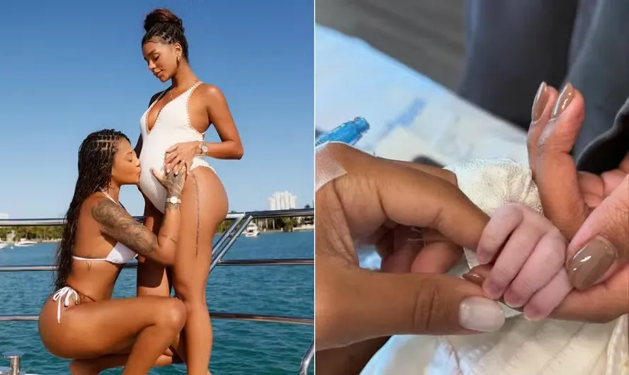A pequena Zuri nasceu nos Estados Unidos