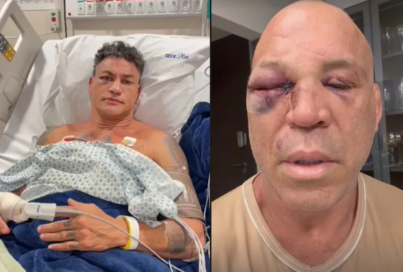 Popó teve que passar por cirurgias nesta segunda-feira (29), enquanto Wanderlei fez nova bateria de exames