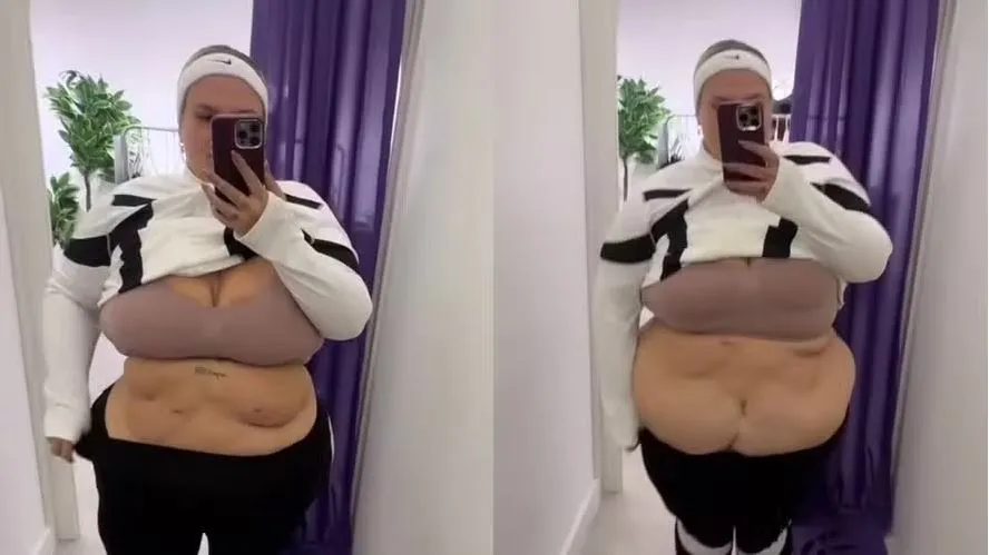 Thais Carla mostra excesso de pele na barriga após cirurgia bariátrica