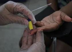 Gonçalenses poderão realizar os testes rápidos para averiguar se têm IST