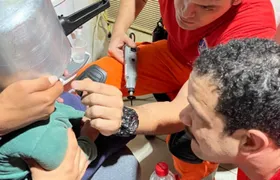 Criança fica com cabeça presa dentro de panela de pressão