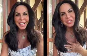 Gretchen surge com novo rosto após harmonização facial e ganha elogios