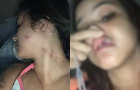 Influenciadora denuncia violência doméstica de pagodeiro em São Gonçalo; “sofri agressão grávida”
