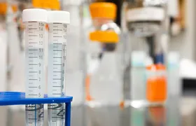Lula veta exigência de exame toxicológico para CNH nas categorias A e B